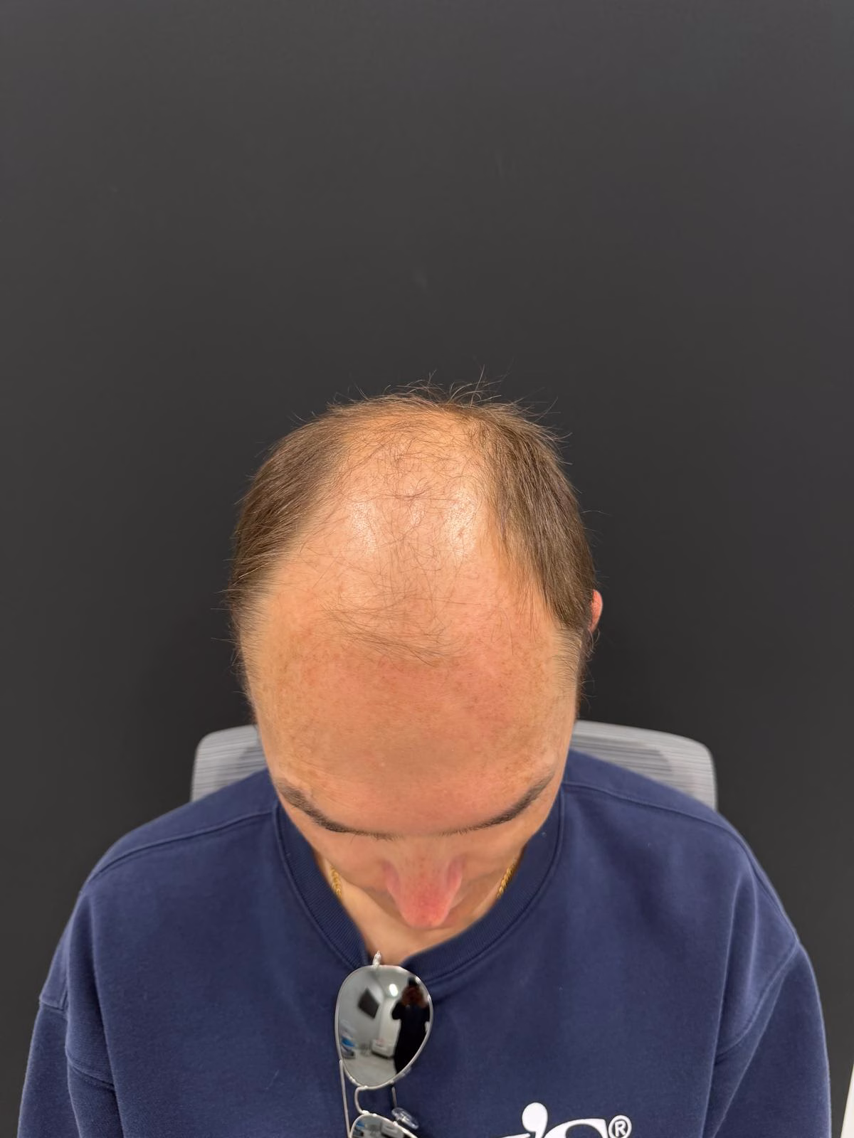 Client 4