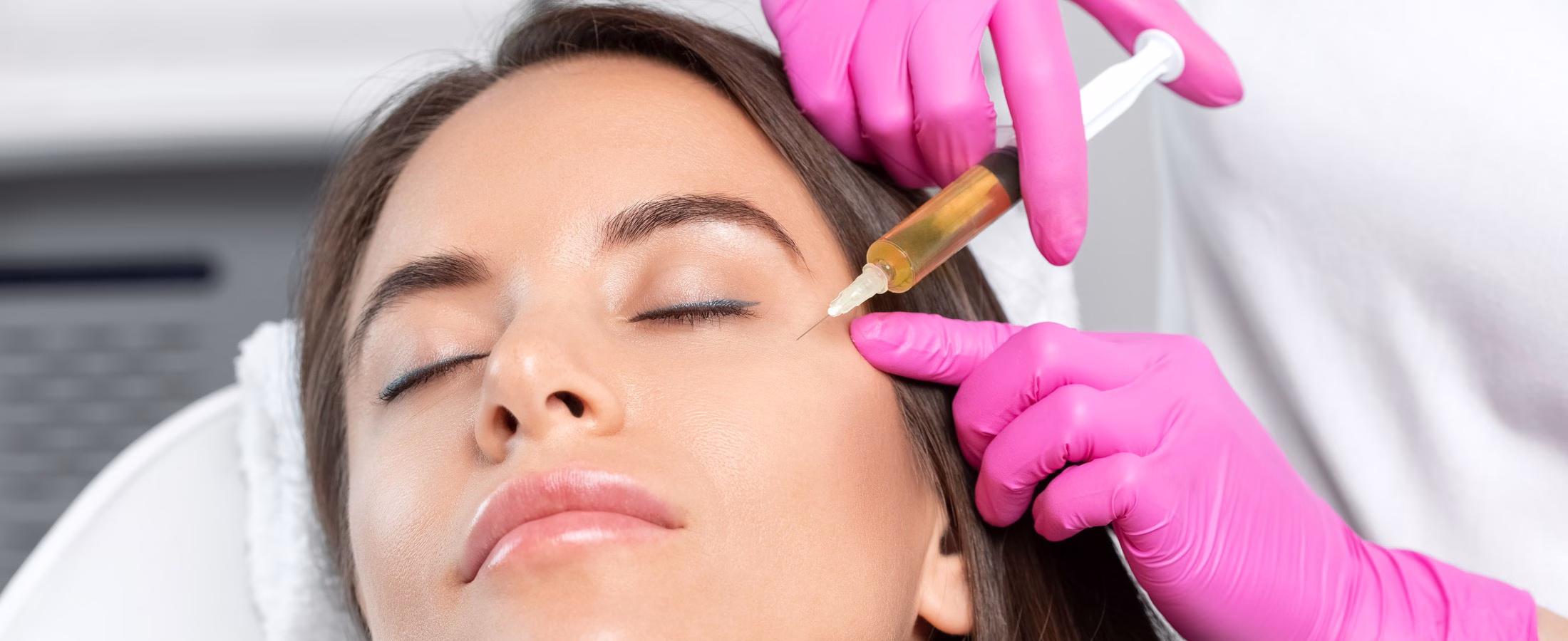 PRP Therapy Face Injection