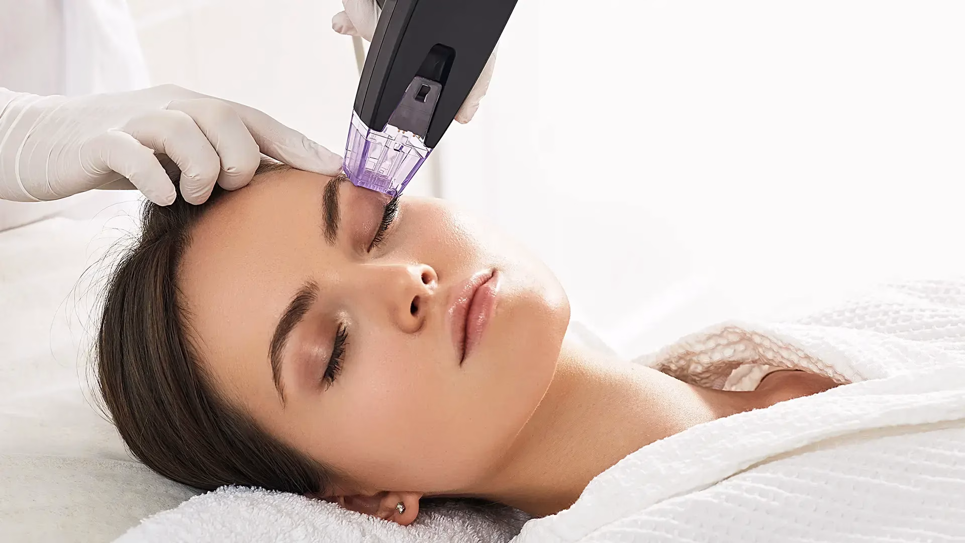 Anti-Pigmentation IPL