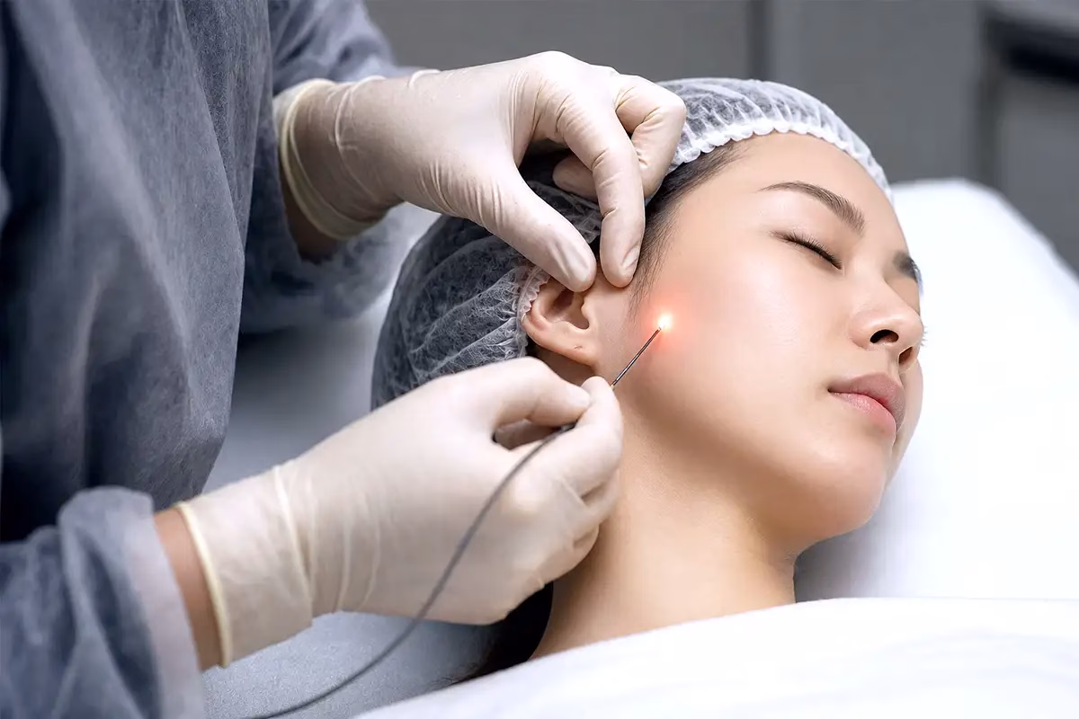 Endolift Laser treatment procedure at AestheteMed