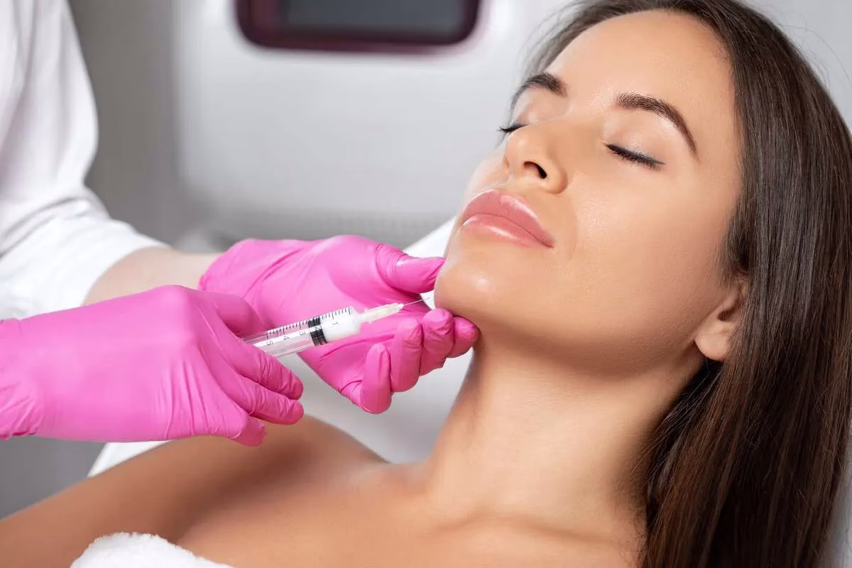 Mint PDO thread lift before and after for jawline definition and jowl reduction