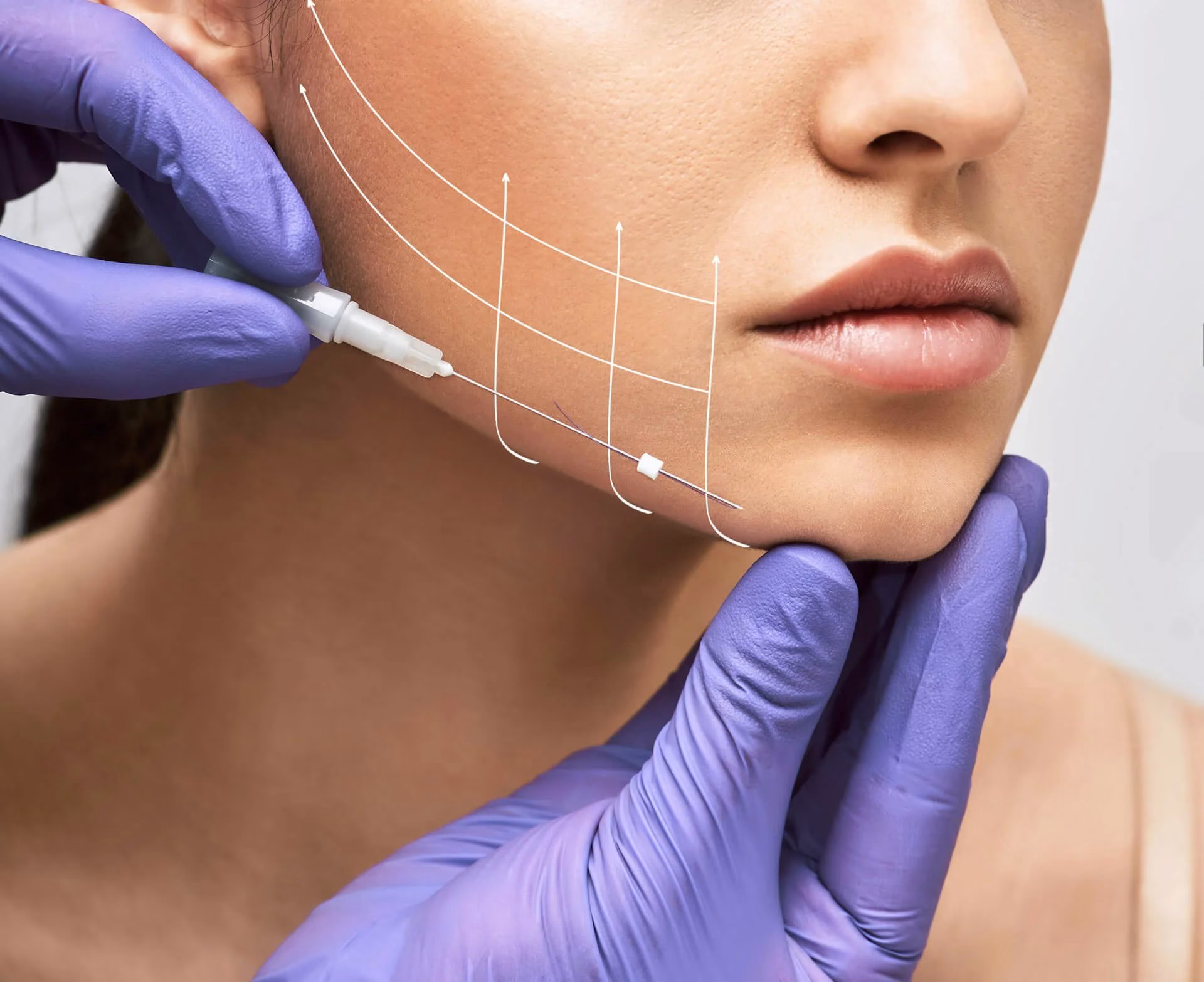 Aesthetemed clinic for PDO thread lift procedures