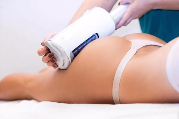 Endospheres Therapy results for cellulite reduction